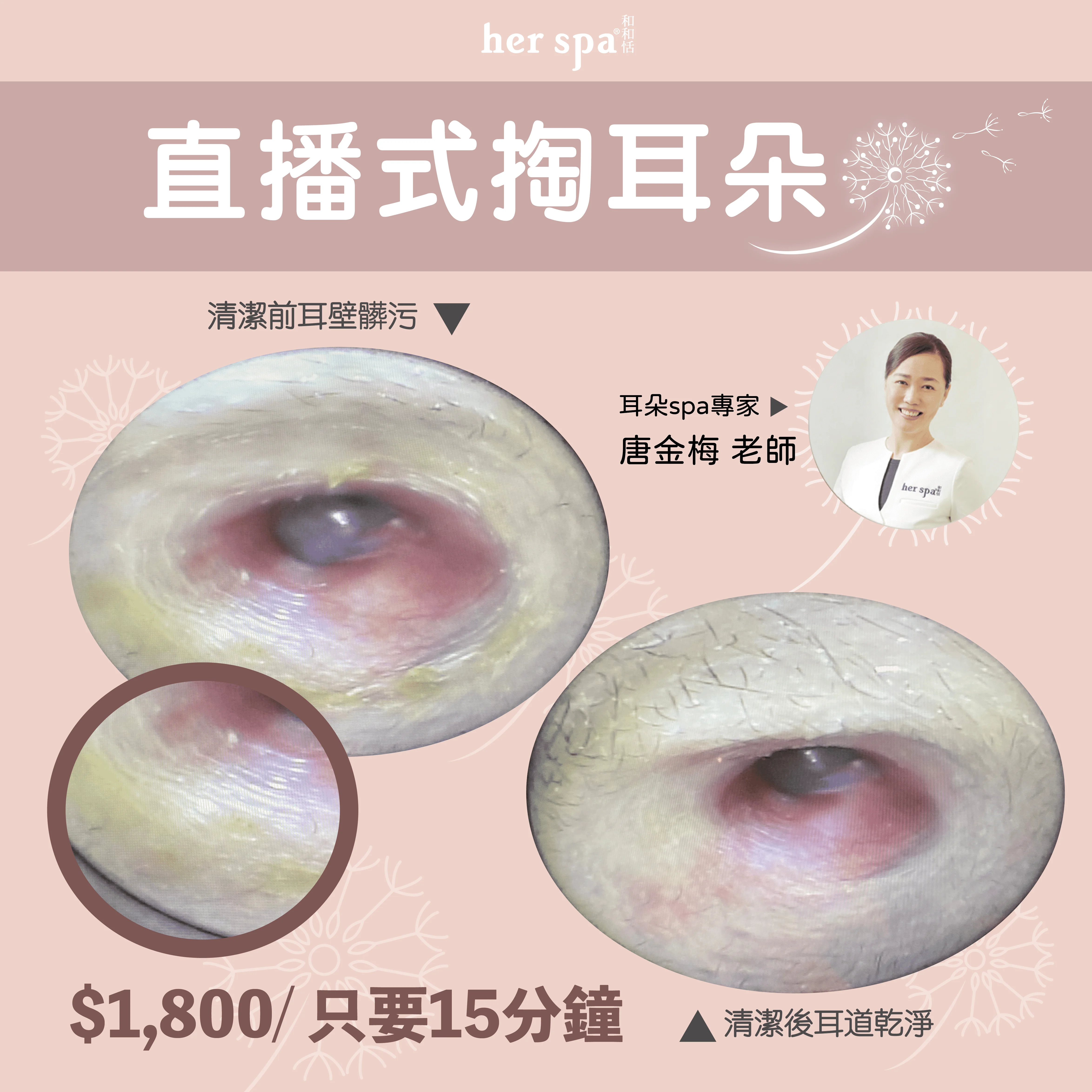 耳道按摩 耳屎 耳朵發炎 耳朵spa 皮脂分泌 耳道按摩 耳屎 耳朵發炎 耳朵spa 皮脂分泌