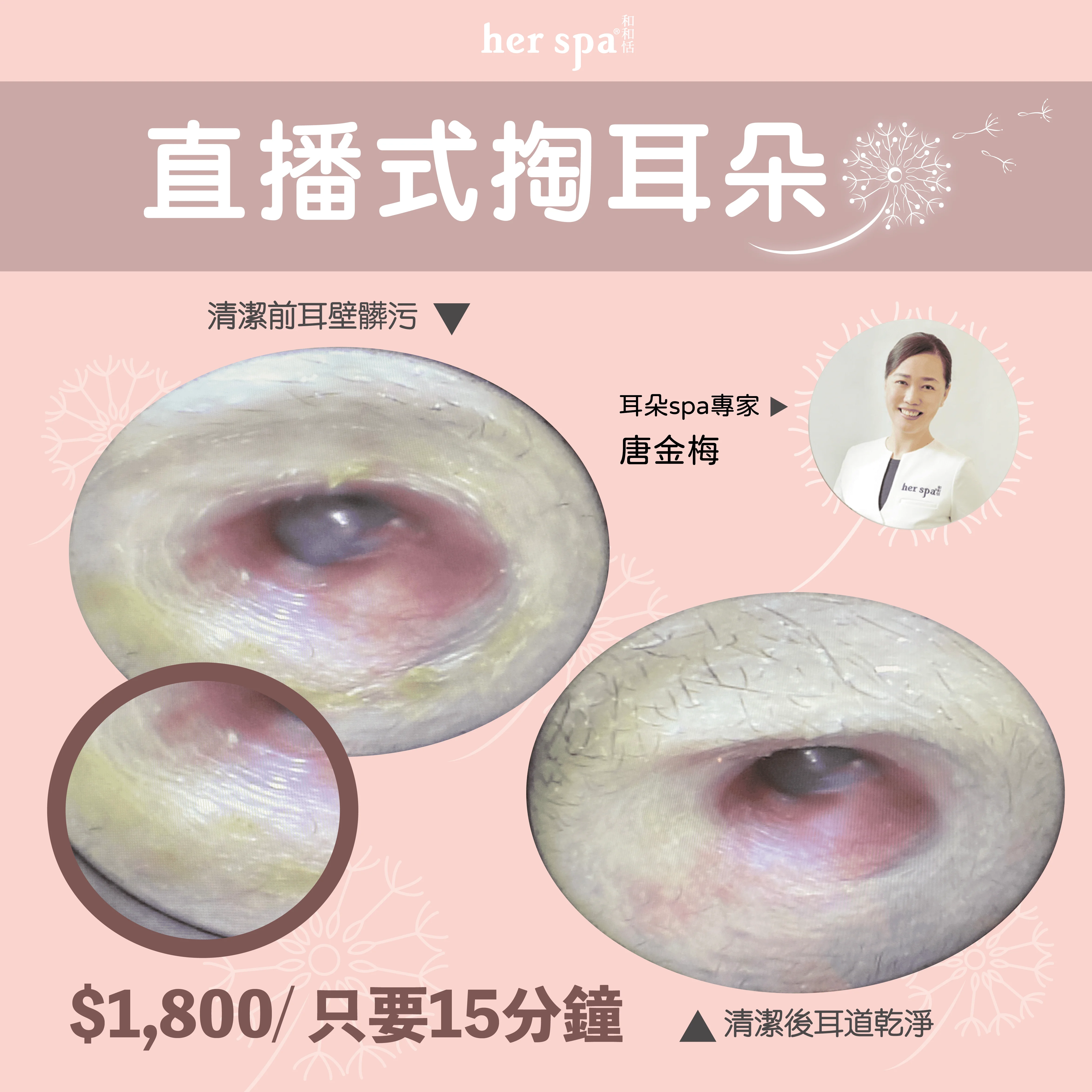 耳垢 耳屎 無痛掏耳 耳朵spa 專業手法