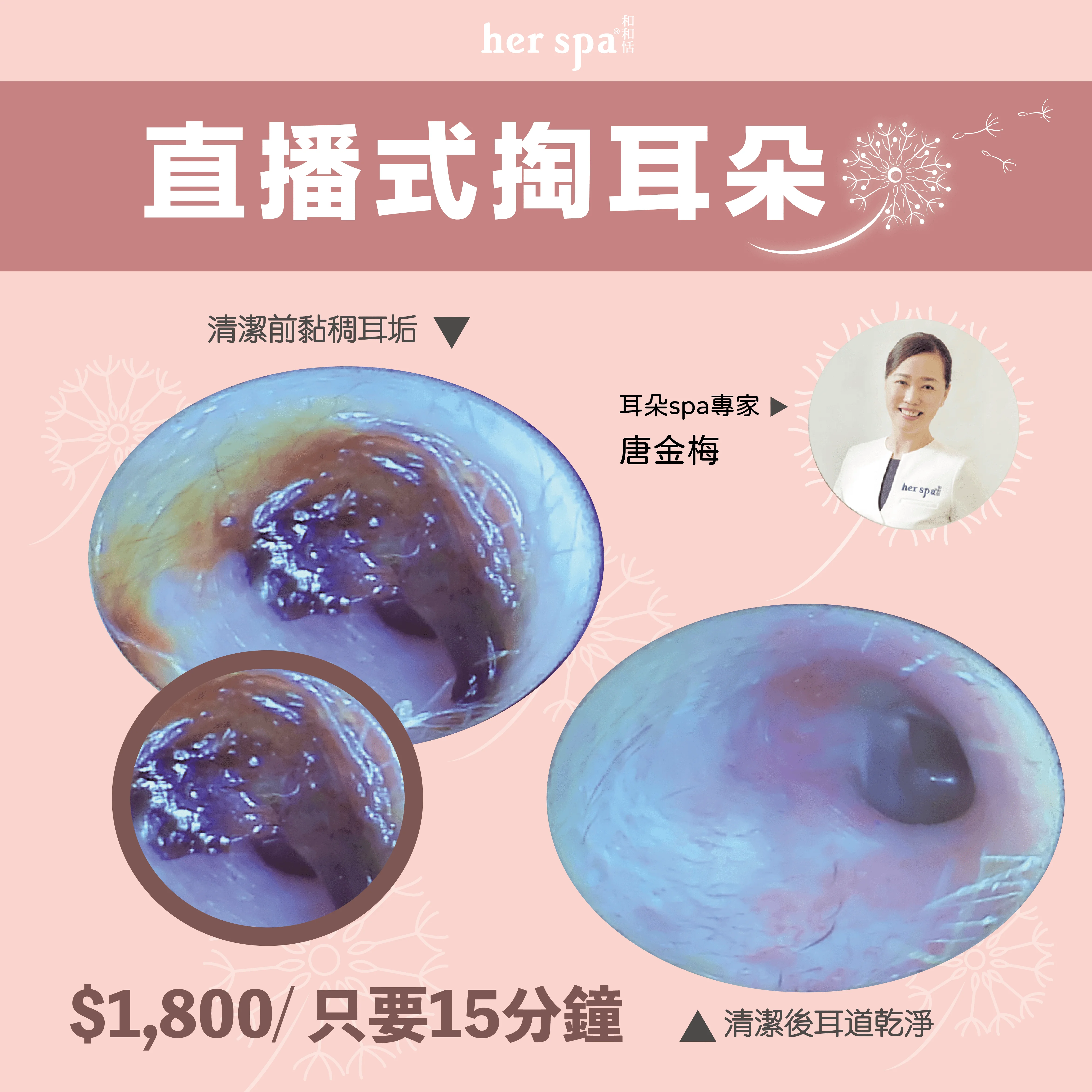 耳垢清潔 清潔耳穴 無痛掏耳 耳朵按摩 唐金梅