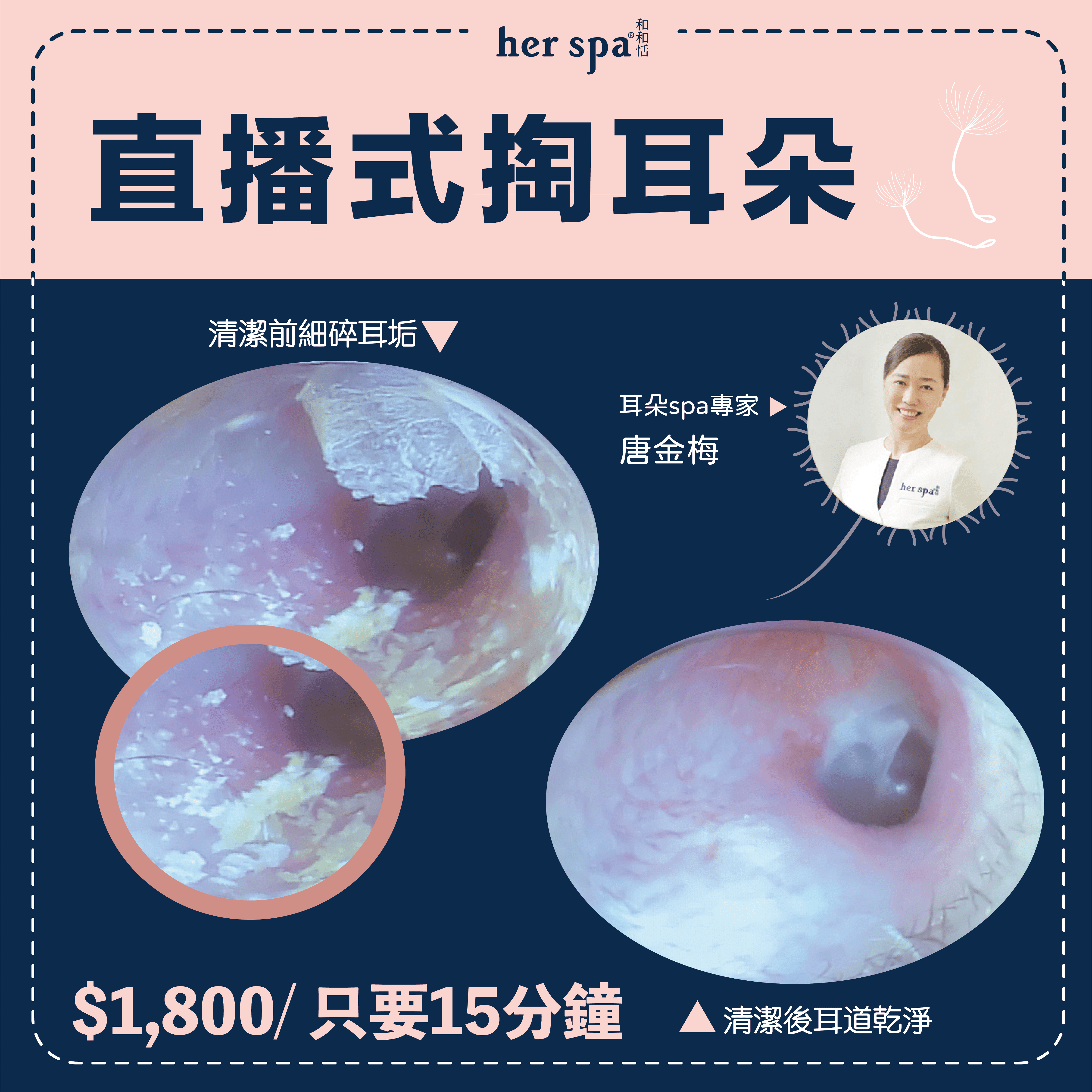 乾耳清潔 掏耳棒推薦 無痛掏耳 耳朵按摩 耳朵怎麼清